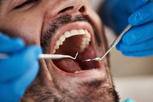 Best Emergency Treatment for Dental Infections or Abscesses in Moapa Valley, NV